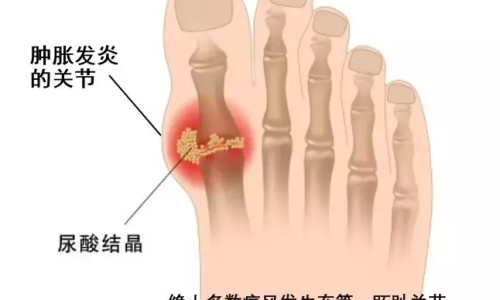 糖尿病人常吃五种食物有效降血糖-糖尿病人降糖食品网 - 为你提供糖尿病人降糖食品有哪些、糖尿病人降糖食品推荐
